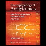 Electrophysiology of Arrhythmias