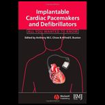 Implantable Cardiac Pacemakers and Defibrillators All You Wanted to Know