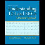 Understanding 12 Lead Ekgs