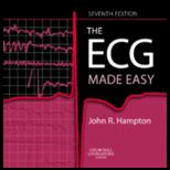 ECG Made Easy