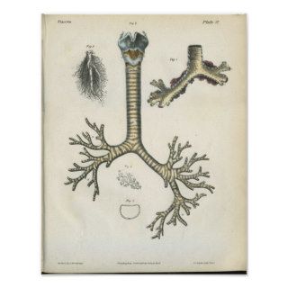 Lung Bronchi Anatomy Print