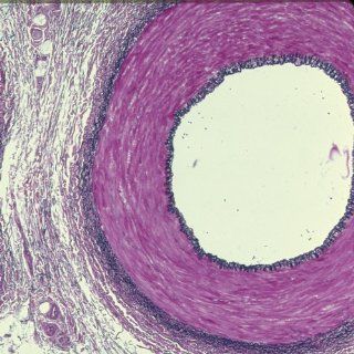 Human Artery and Vein c.s. 7 µm Verhoeff's stain Microscope Slide
