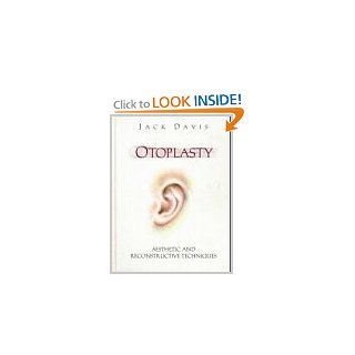 Otoplasty Aesthetic and Reconstructive Techniques (Singular Textbook) (9783540745945) Jack Davis Books