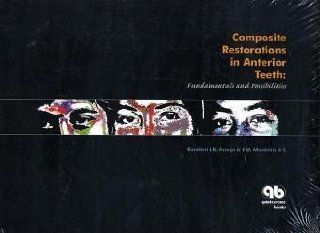 Composite Restoration in Anterior Teeth Fundamentals And Possibilities (9788587425591) Luiz Narciso Baratieri, E. M., Jr. Aruajo, S., Jr. Monteiro Books