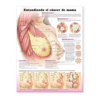 Understanding Breast Cancer Spanish Entendiendo el cncer de mama (Spanish Edition) (9780781772242) Anatomical Chart Company Books