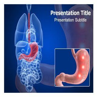 Peptic Ulcer Powerpoint Templates   Peptic Ulcer PowerPoint Background   Peptic Ulcer (PPT) Slides Software