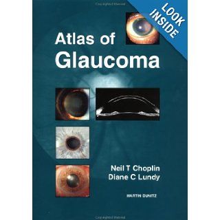 Atlas of Glaucoma, Second Edition (Softcover Special Edition) Neil T. Choplin, Diane C. Lundy 9781853173752 Books