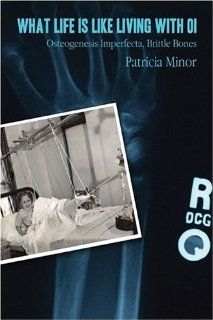 What Life Is Like Living with OI Osteogenesis Imperfecta, Brittle Bones Patricia Minor 9781424114177 Books