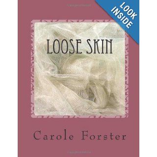 Loose Skin Prevention and Cure (Volume 1) Ms Carole Forster 9781477583470 Books