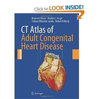 CT Atlas of Adult Congenital Heart Disease Wojciech Mazur, Marilyn J. Siegel, Tomasz Miszalski Jamka, Robert Pelberg 9781447150879 Books