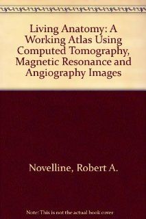 Living Anatomy A Working Atlas Using Computed Tomography, Magnetic Resonance and Angiography Images 9780801647468 Science & Mathematics Books @