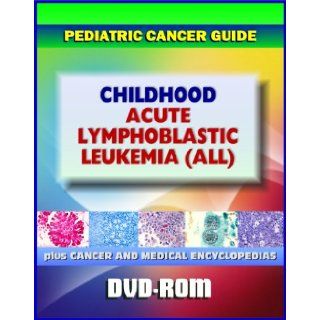 Childhood Acute Lymphoblastic Leukemia (ALL) Pediatric Cancer Guide to Causes, Signs and Symptoms, Testing and Diagnosis, Treatment Options, Prognosis, Clinical Trials and Research (DVD ROM) Medical Ventures Press 9781422054062 Books