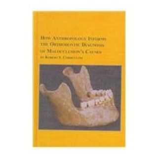 How Anthropology Informs the Orthodontic Diagnosis of Malocclusion's Causes (Mellen Studies in Anthropology, 1) 9780773479807 Medicine & Health Science Books @