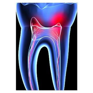 Tooth pain, toothache Invitations by ADMIN_CP_GETTY35497297