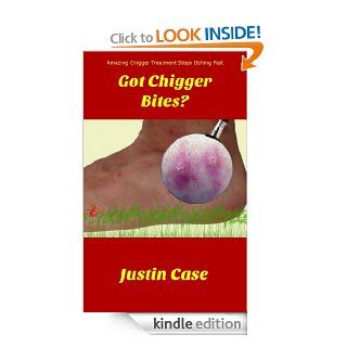 Got Chigger Bites? eBook Justin Case Kindle Store
