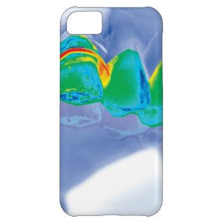 Stylish iPhone 5 case for dentists