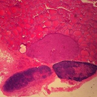 Mammal Thyroid Gland and Parathyroid Gland, sec. 7 µm H&E Microscope Slide