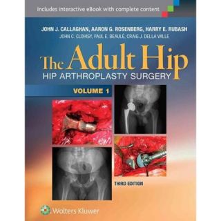 The Adult Hip Hip Arthroplasty Surgery, Inclues Interactive eBook with Complete Content